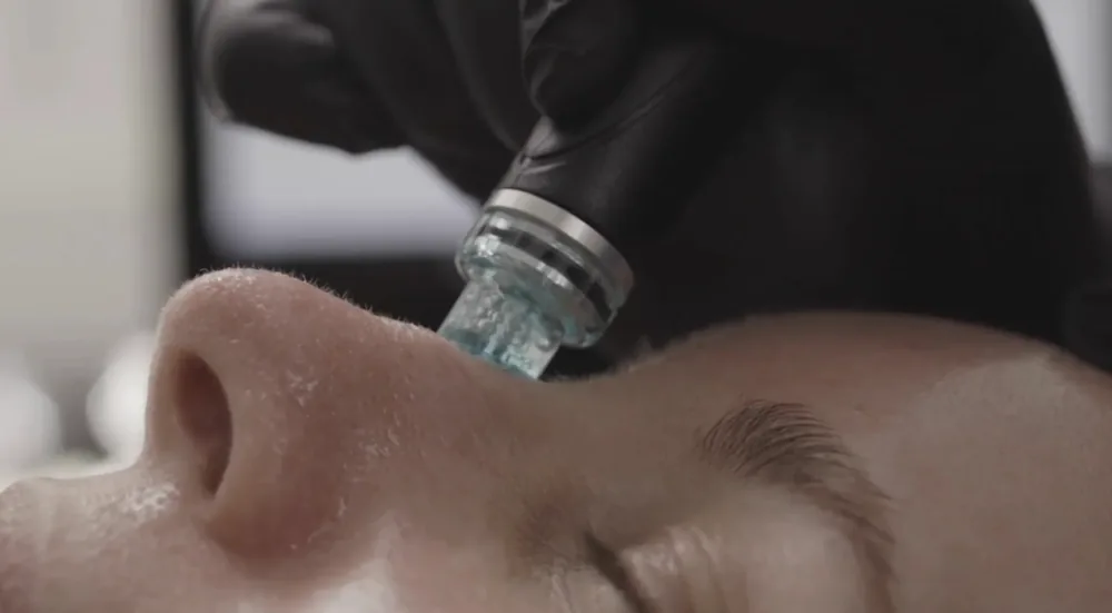 Hydrafacial