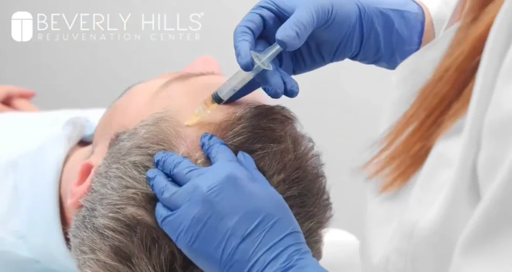 See PRP Hair Restoration in Action