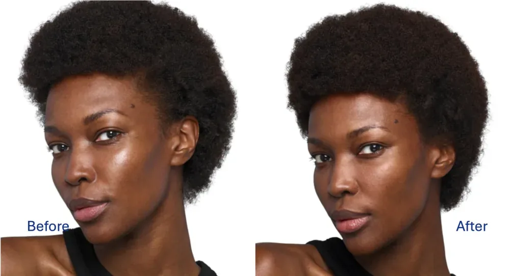 Skinvive before and after result