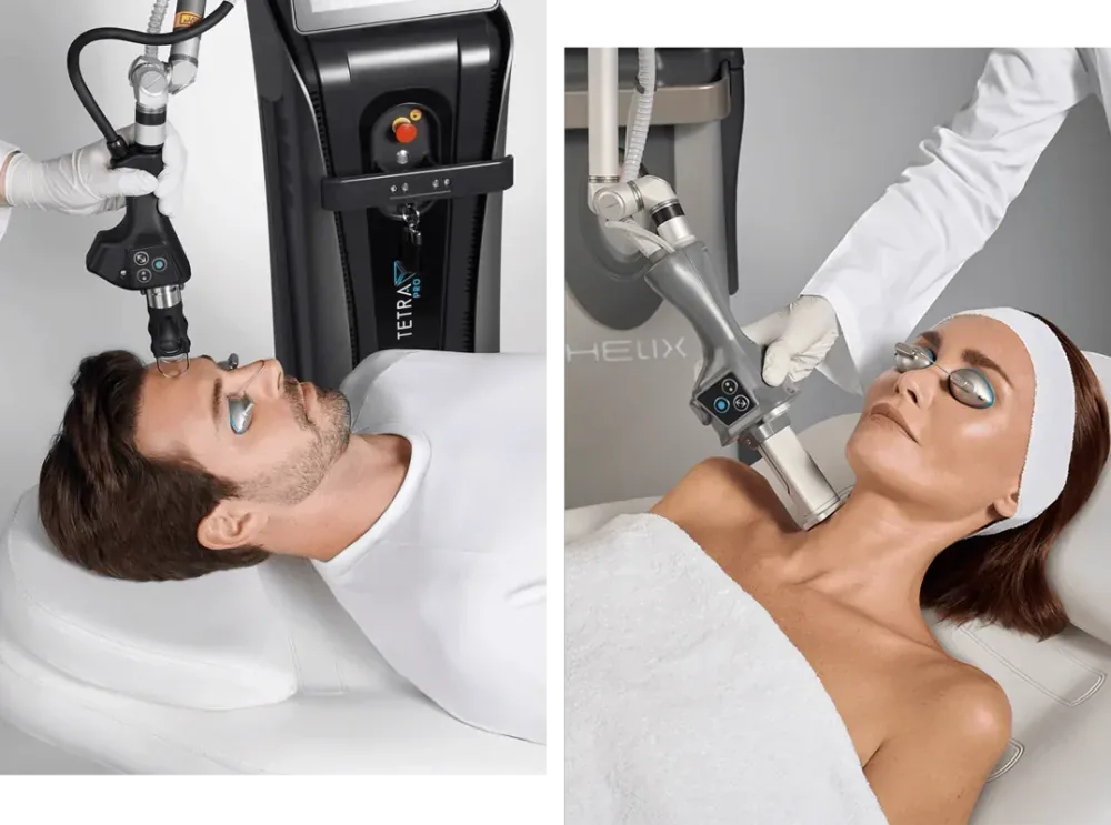 CO2 Cartessa CoolPeel
