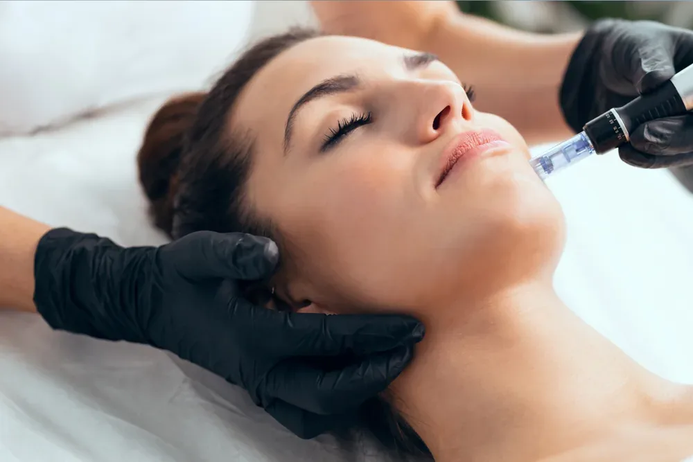 See Microneedling in Action