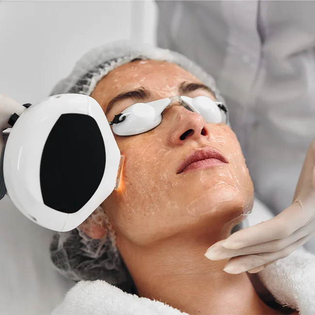 PRP Facial