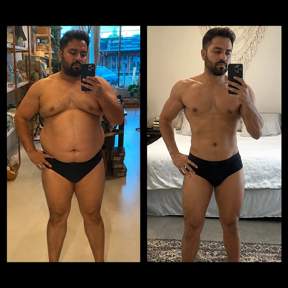 Tirzepatide progress journey result, patient 1